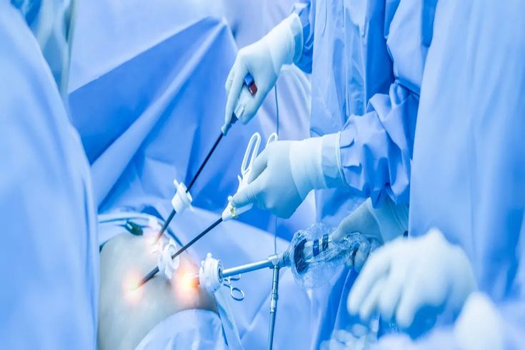 Laparoscopic Surgery